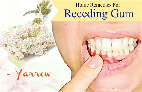 18 Natural Home Remedies For Receding Gum Pain Relief