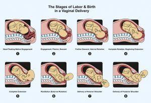 Natural Childbirth