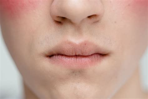 beautiful cheeks      beautiful cheeks stock