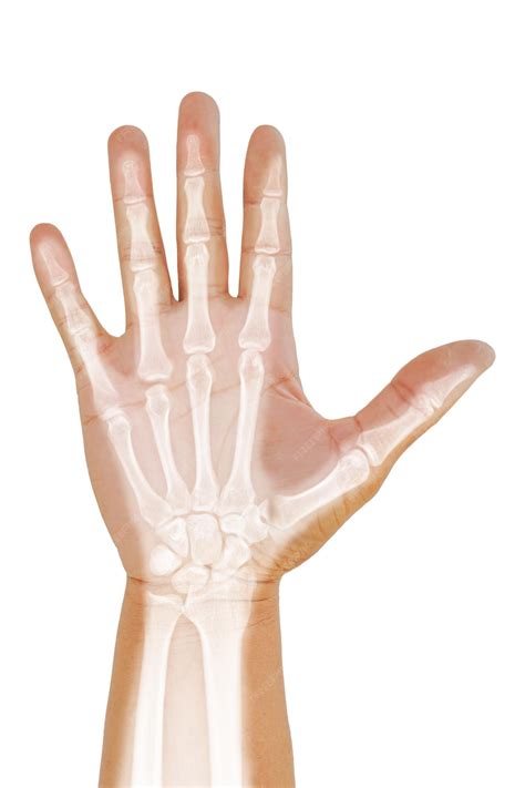 Premium Photo | Hand and wrist xray lateral view medical image concept