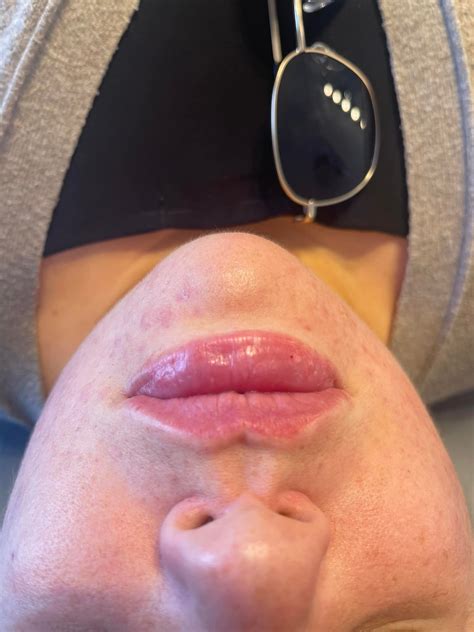 Amelia Skye Beauty & Aesthetics | Glossop