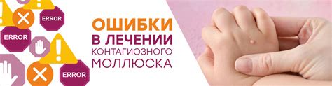 Контагиозный моллюск: как распознать и как правильно лечить?