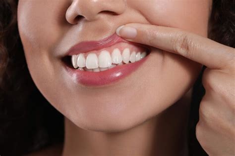 Why Do Teeth Bleed So Much? (Causes, Risks & Treatment)