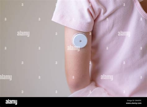Blutzuckermessgert Sensor Am Arm Kaufen