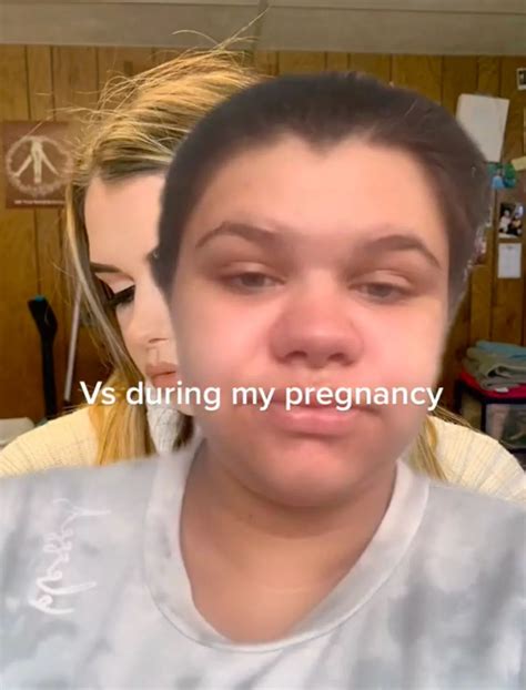 Woman shares before and after pregnancy pics – and difference is