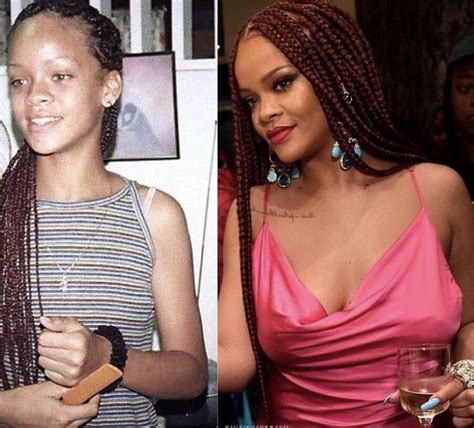 Before & after | Rihanna riri, Rihanna, Rhianna