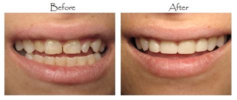 Cosmetic Dentist Finance