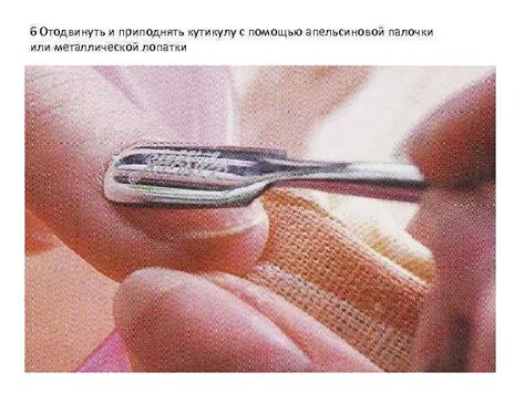 Проблемные ногти Инфекции ногтей Грибковые поражения
