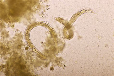 Pin Worms